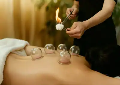 Séance de ventouses pour relaxation et détoxification du corps.
